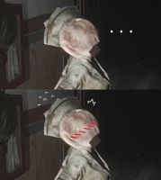 86170